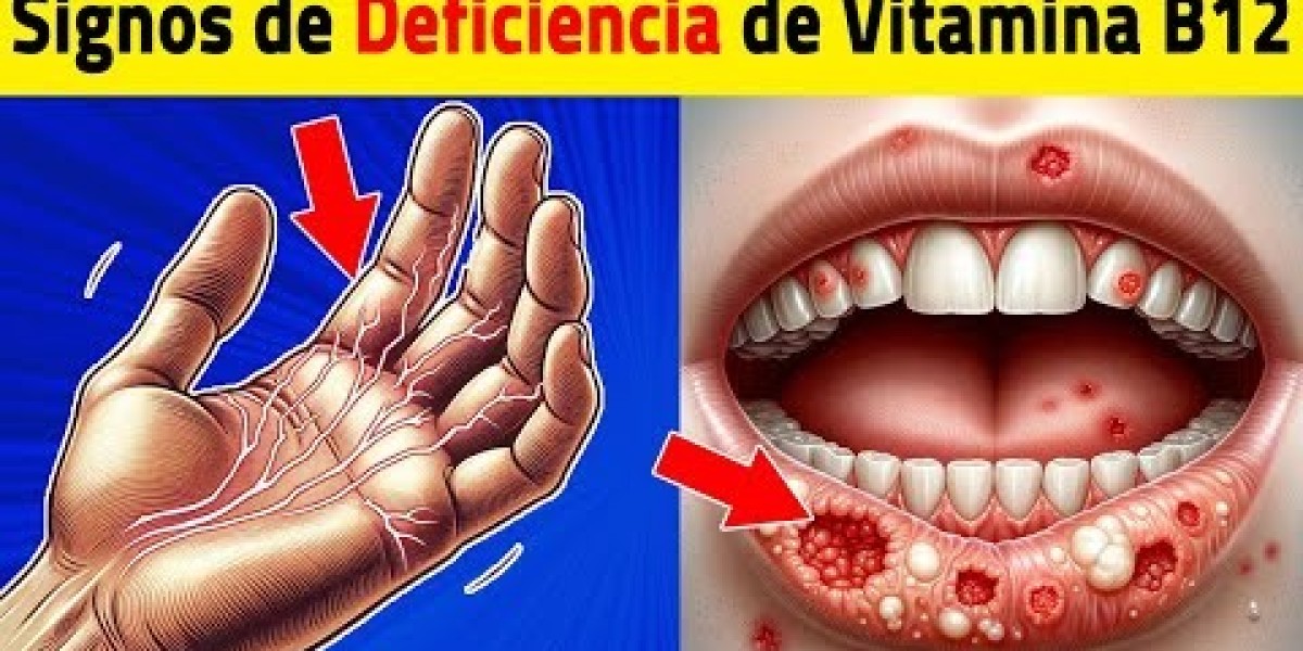 Cuidado con la biotina: un problema creciente en la práctica clínica Endocrinología, Diabetes y Nutrición