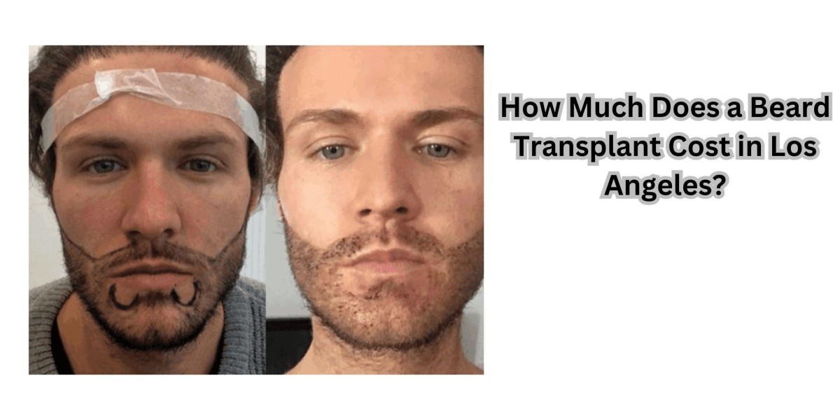 How Much Does a Beard Transplant Cost in Los Angeles?